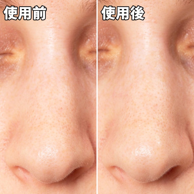 クリアスパー 毛穴パック 炭を他商品と比較 口コミや評判を実際に使ってレビューしました Mybest