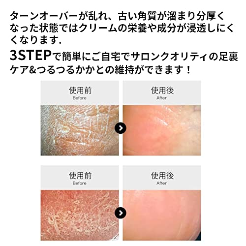 コウンバル 3