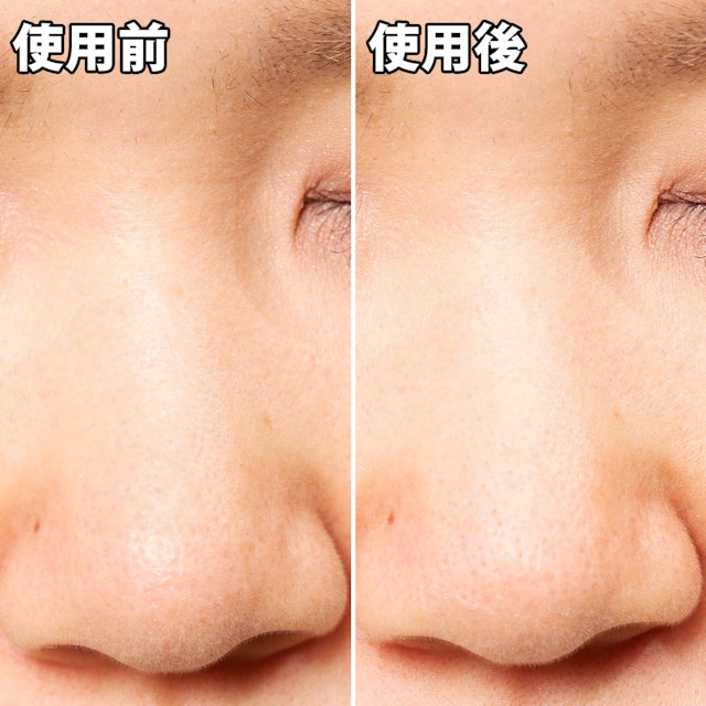 ビオレ 毛穴すっきりパック 鼻用 白色タイプを他商品と比較 口コミや評判を実際に使ってレビューしました Mybest