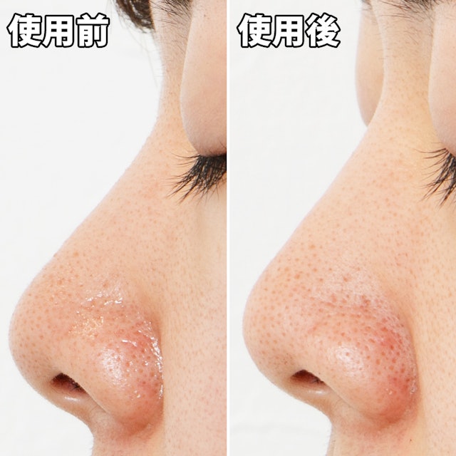 ナリスアップ 毛穴すっきりパックを他商品と比較 口コミや評判を実際に使ってレビューしました Mybest ナリスアップ 毛穴すっきりパックを他商品と比較 口コミや評判を実際に使ってレビューしました Mybest