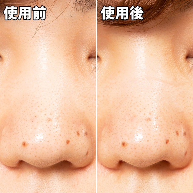 Matsukiyo 毛穴パック炭を他商品と比較 口コミや評判を実際に使ってレビューしました Mybest Matsukiyo 毛穴パック炭を他商品と比較 口コミや評判を実際に使ってレビューしました Mybest