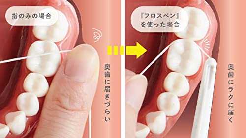 フロスペン 2