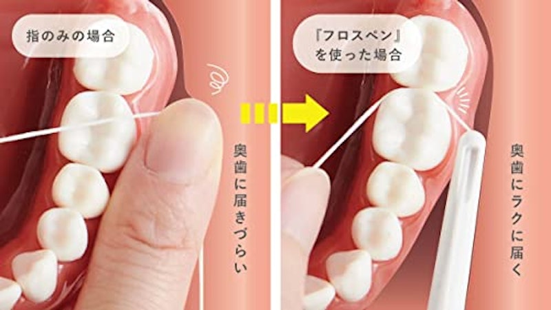 フロスペン 2