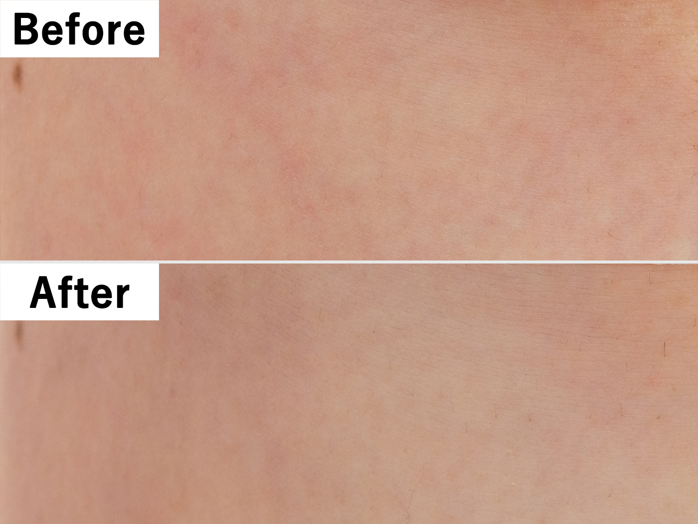 ジョモタン 除毛クリームを全14商品と比較 口コミや評判を実際に使ってレビューしました Mybest