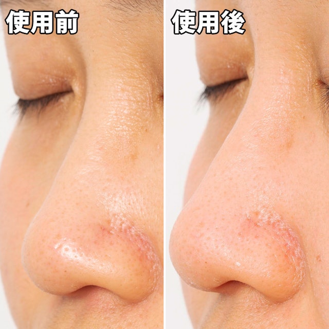 ビオレ 毛穴すっきりパック 鼻用 白色タイプを他商品と比較 口コミや評判を実際に使ってレビューしました Mybest ビオレ 毛穴すっきりパック 鼻用 白色タイプを他商品と比較 口コミや評判を実際に使ってレビューしました Mybest