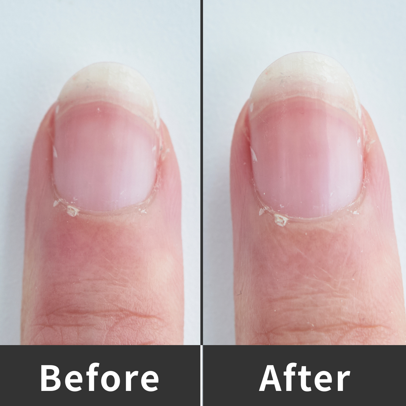 21年 爪磨きのおすすめ人気ランキング18選 徹底比較 Mybest