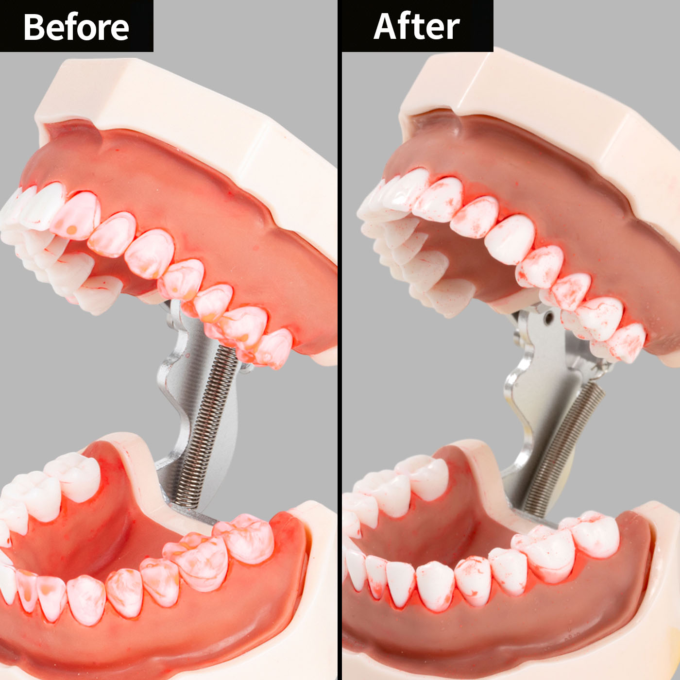 P&Gジャパン オーラルB iO6 IOM62J61KGR-Wを検証レビュー！電動