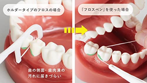フロスペン 3