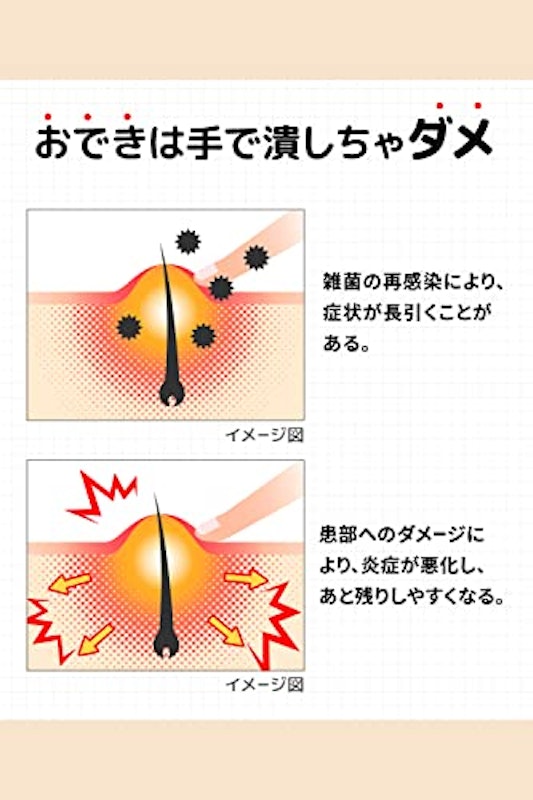 オデキュアEX 6