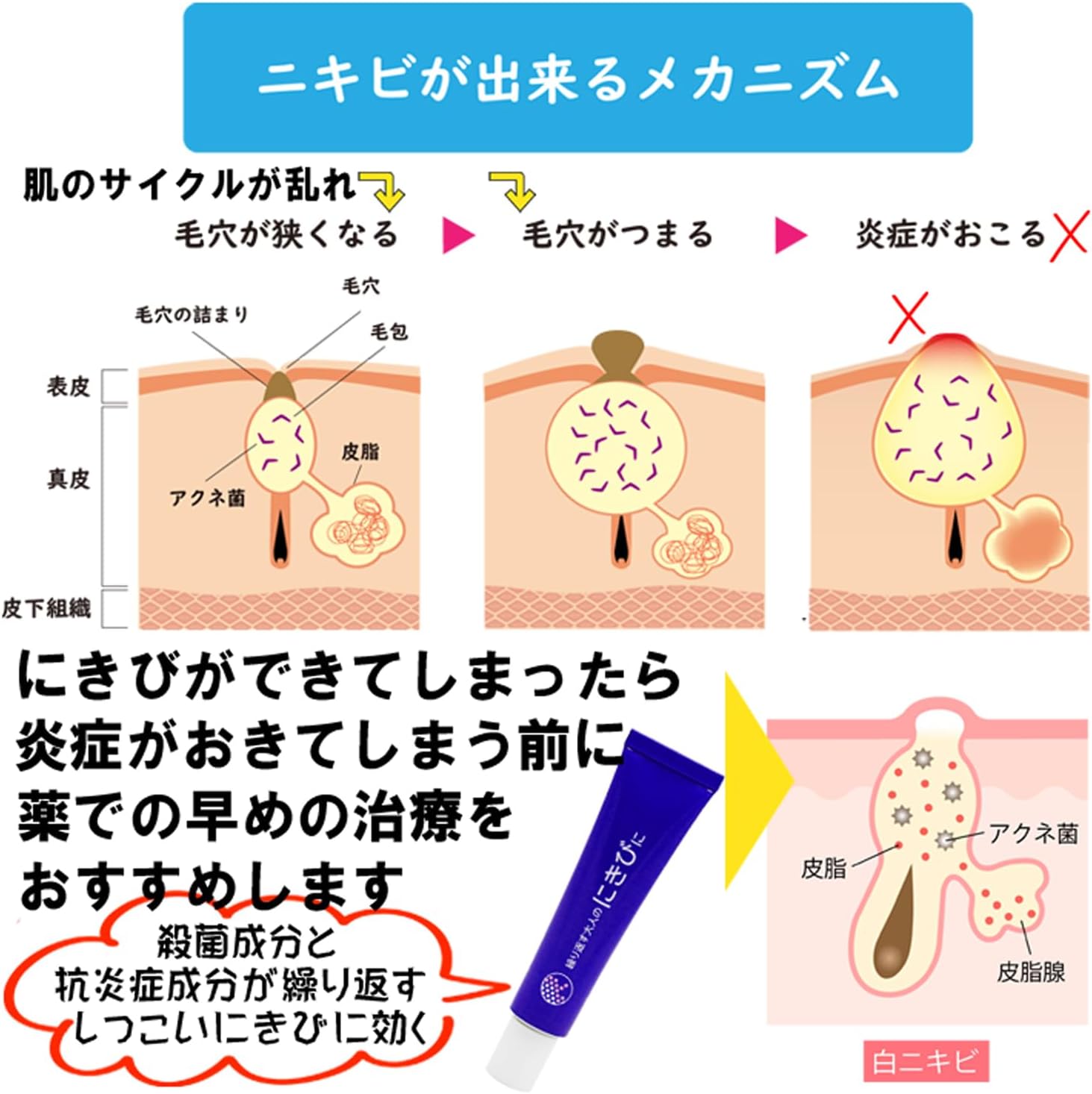 ラウマーアクネクリーム 6