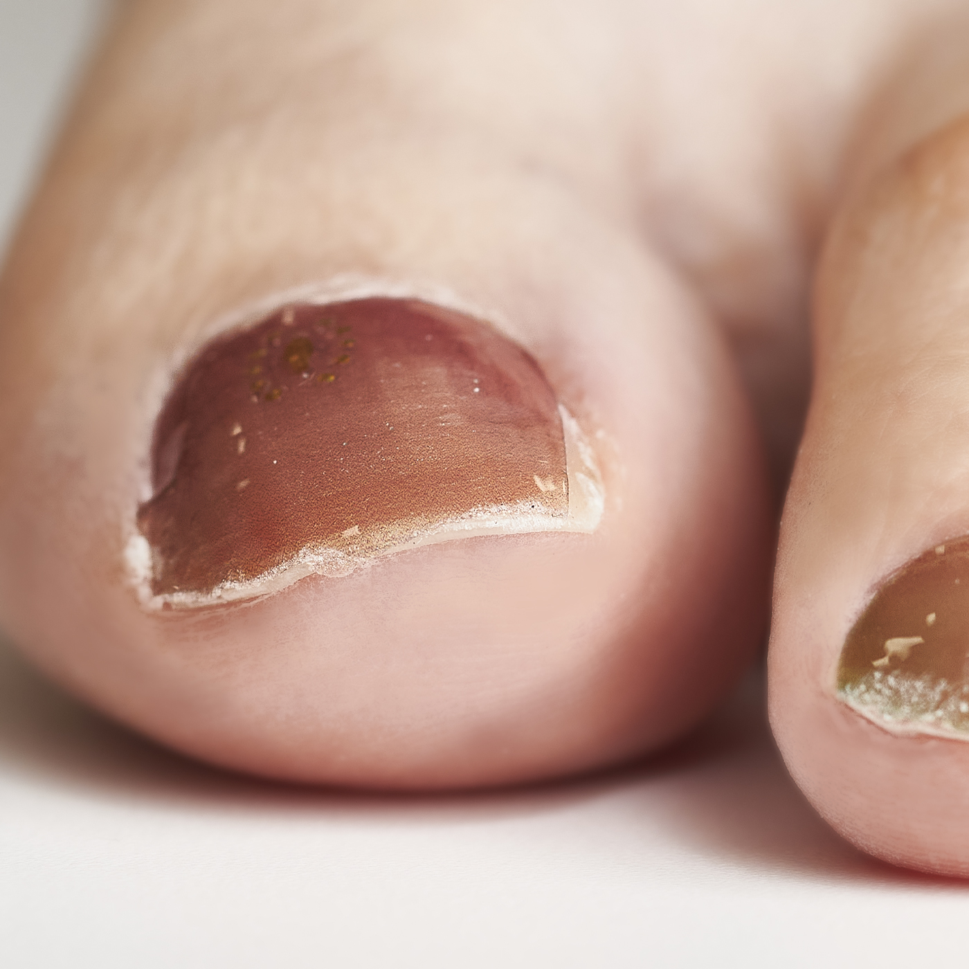 Zinipin フットネイルを全9商品と比較 口コミや評判を実際に使ってレビューしました Mybest