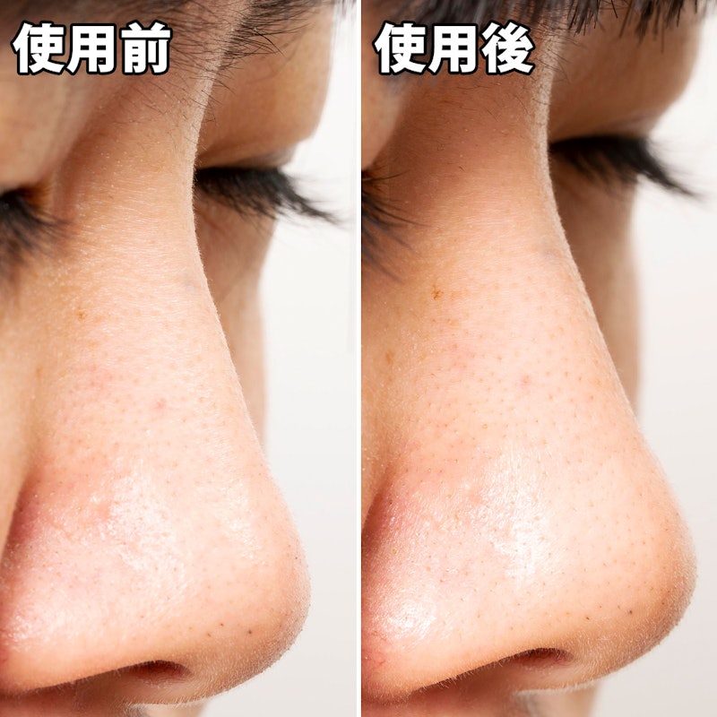 徹底比較 鼻の黒ずみ除去パックのおすすめ人気ランキング18選 Mybest