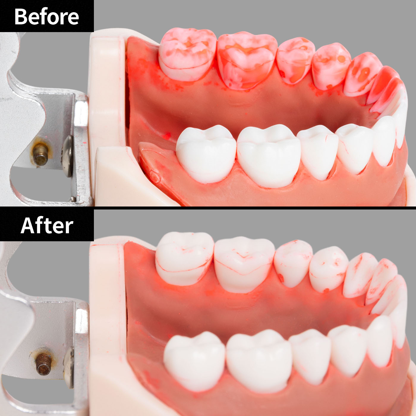 ジーシー RUSCELLO ルシェロ歯ブラシP-20 ピセラ P20Mを検証レビュー