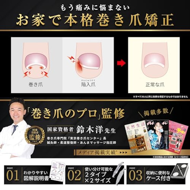 巻き爪 クリップ 2