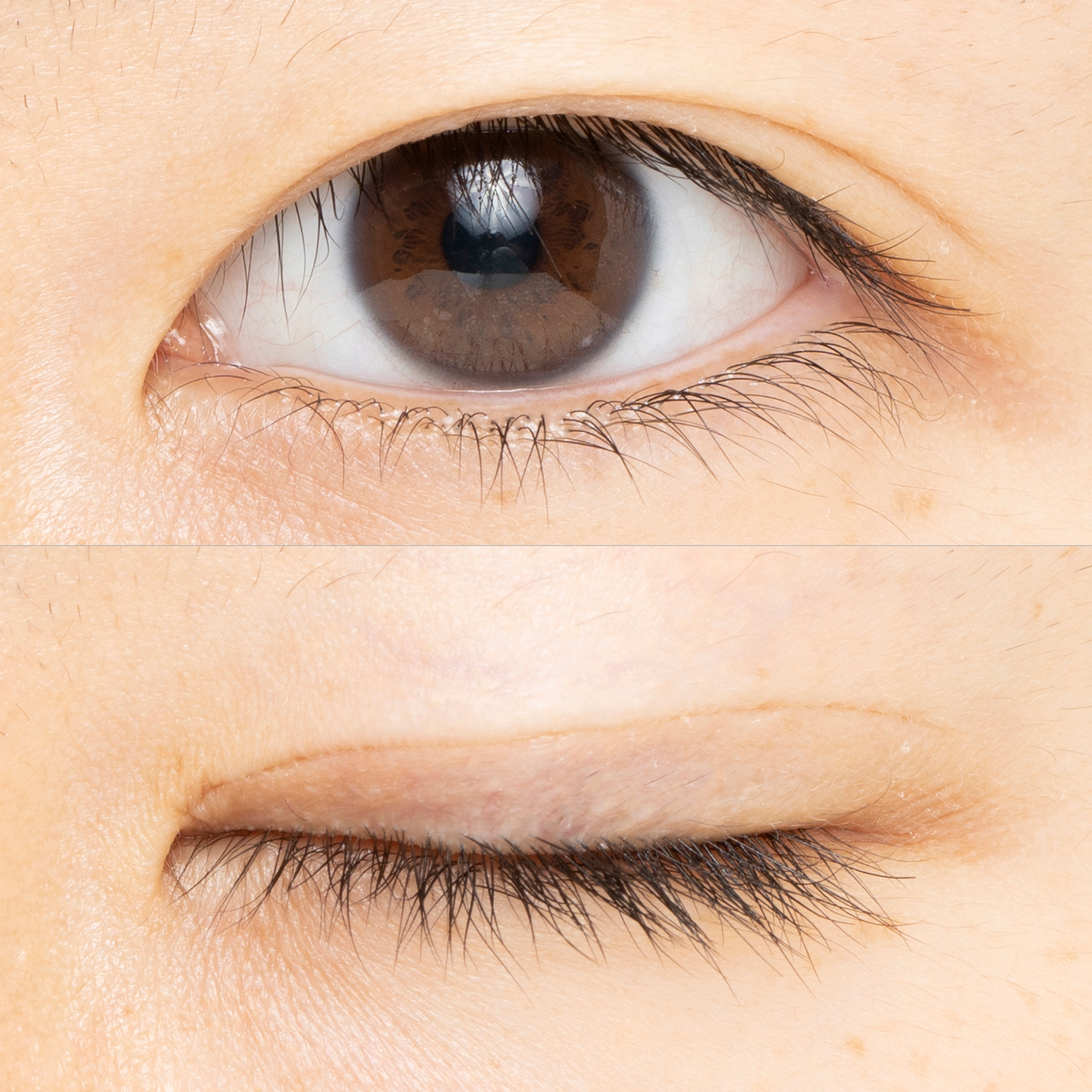 アストレア ヴィルゴ アイビューティーフィクサー WPをレビュー