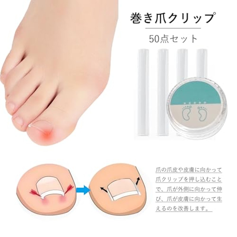 巻き爪クリップ 2