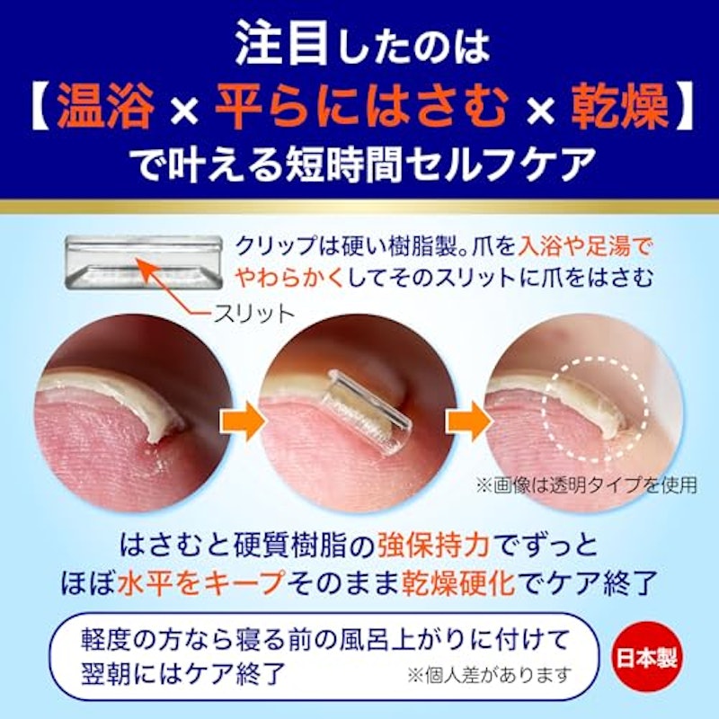 カールネイル 巻き爪クリスタルケア 4