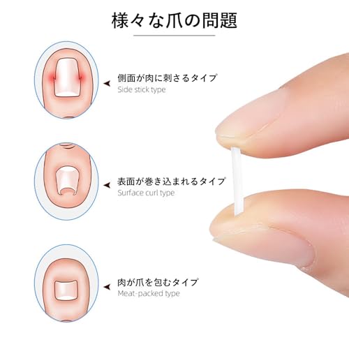 巻き爪クリップ 3