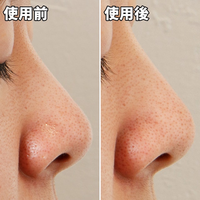 ナリスアップ 毛穴すっきりパックを他商品と比較 口コミや評判を実際に使ってレビューしました Mybest ナリスアップ 毛穴すっきりパックを他商品と比較 口コミや評判を実際に使ってレビューしました Mybest