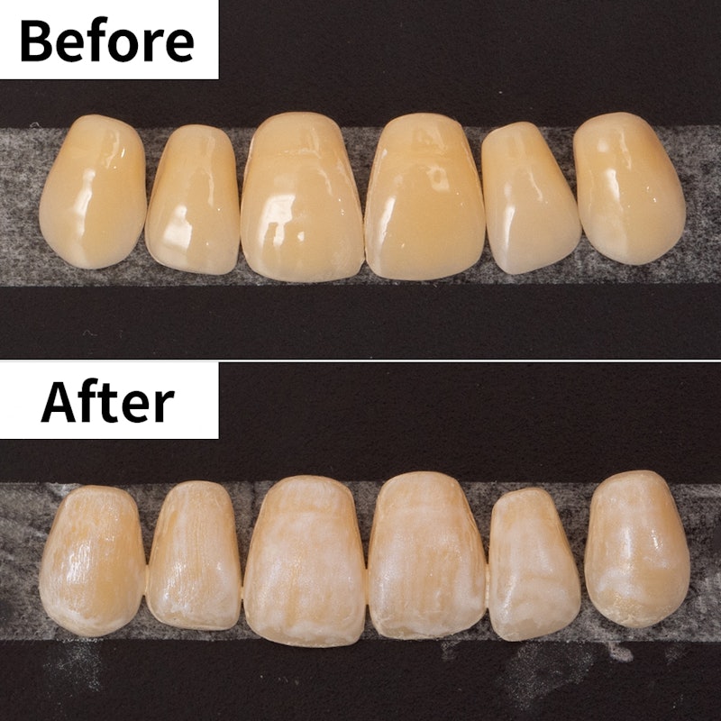 22年9月 歯マニキュアのおすすめ人気ランキング8選 徹底比較 Mybest 22年9月 歯マニキュアのおすすめ人気ランキング8選 徹底比較 Mybest