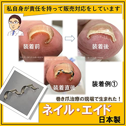 ネイル・エイド 7