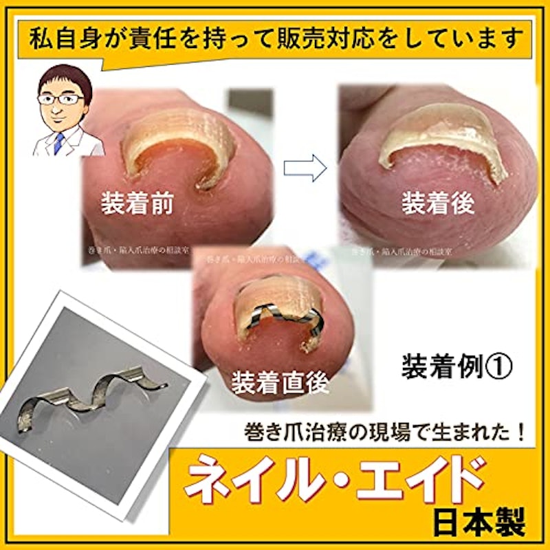 ネイル・エイド 7