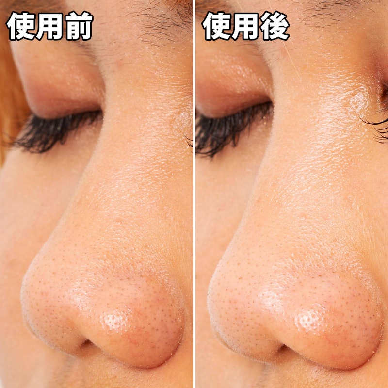 徹底比較 鼻の黒ずみ除去パックのおすすめ人気ランキング18選 Mybest