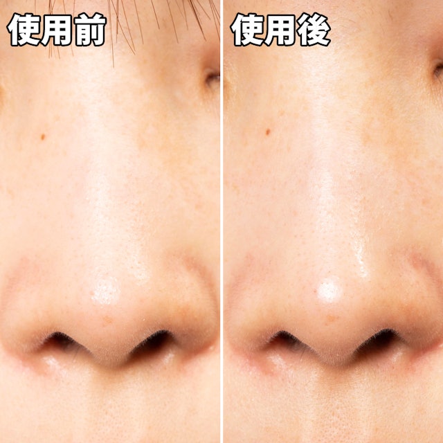 クリアスパー 毛穴パック 炭を他商品と比較 口コミや評判を実際に使ってレビューしました Mybest クリアスパー 毛穴パック 炭を他商品と比較 口コミや評判を実際に使ってレビューしました Mybest