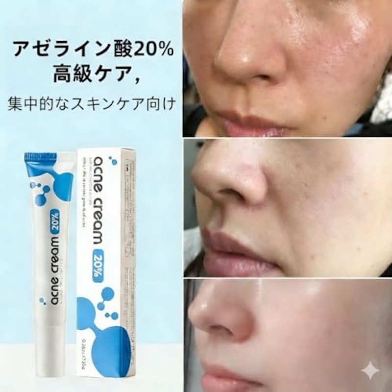 アゼライン酸クリーム 12% 鎮静・整肌 敏感肌向け 5