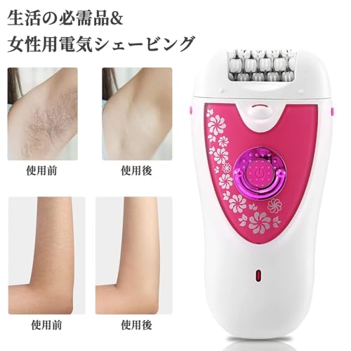電気エピレーター 6