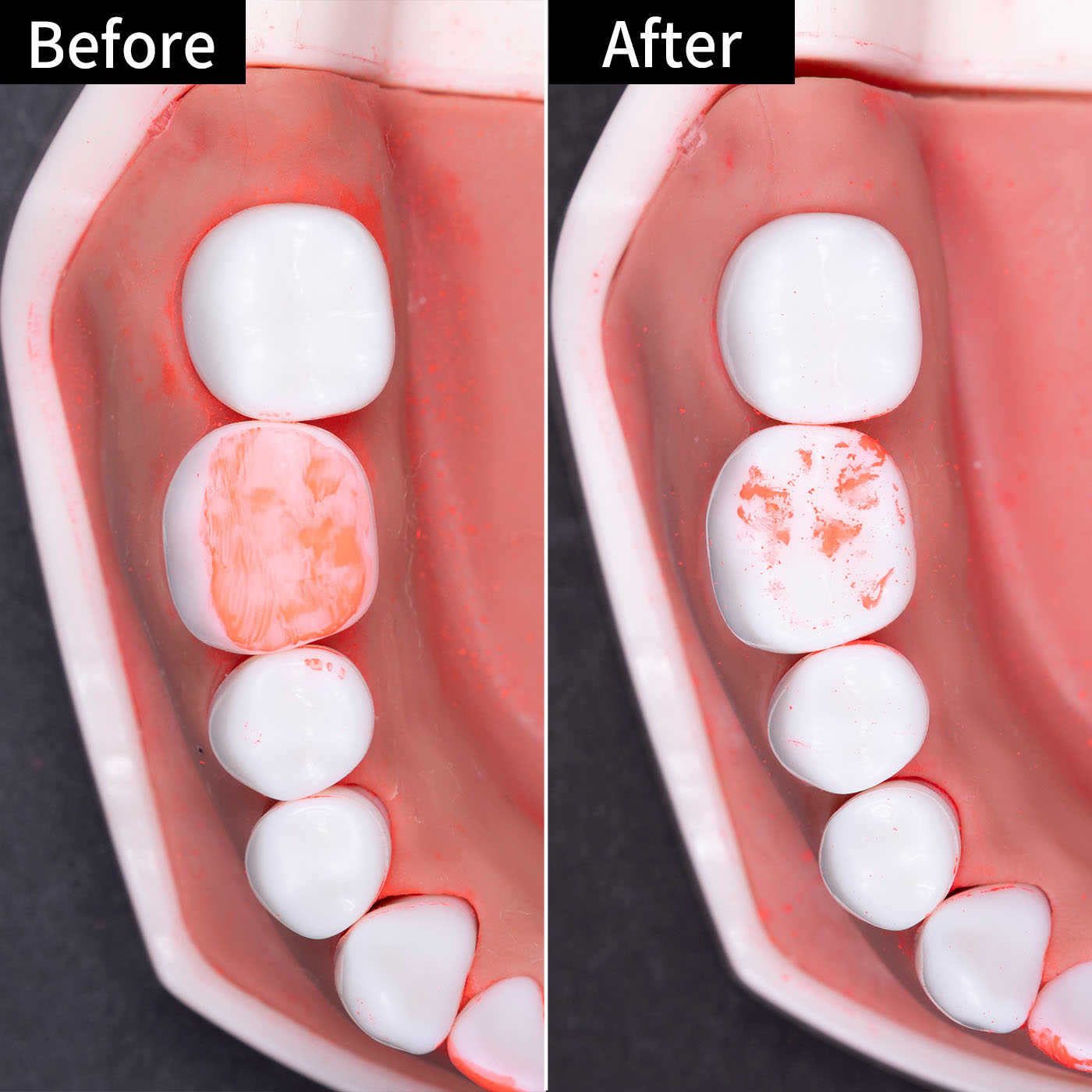 P&G Oral-B iO5 iOG52J62KBK クチコミ評価・評判&検証レビュー 2