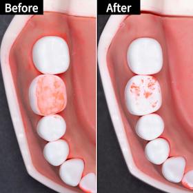 P&G Oral-B iO5 iOG52J62KBK クチコミ評価・評判&検証レビュー 2