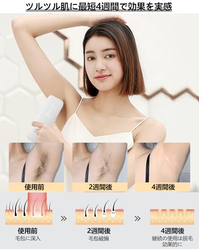  脱毛器 5