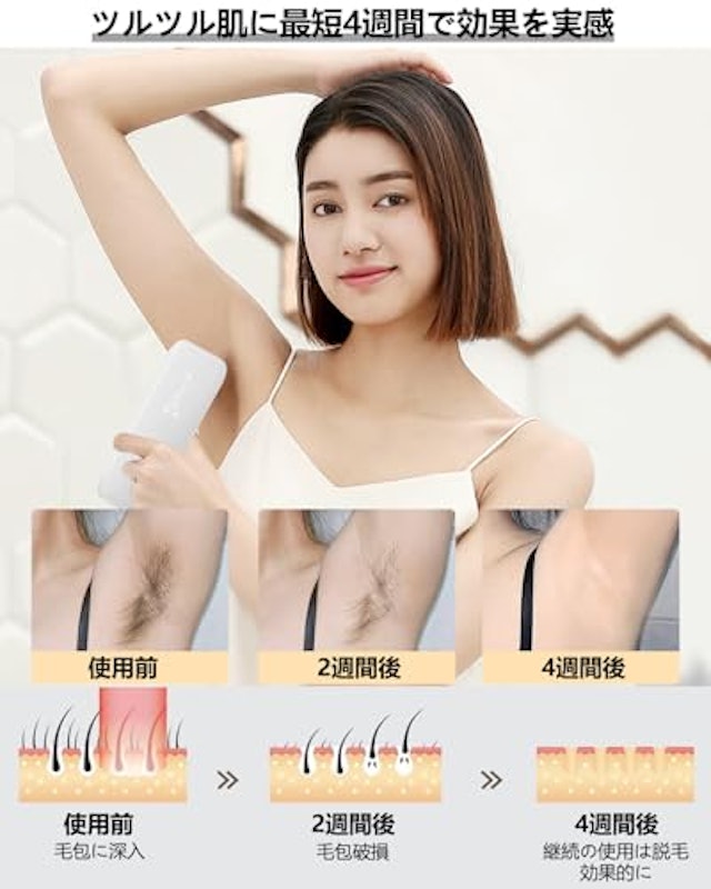 脱毛器 5