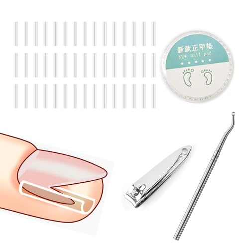巻き爪クリップ 1
