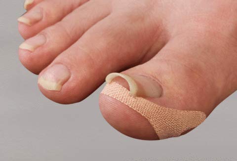 巻き爪テープ　クイこまなーい 4