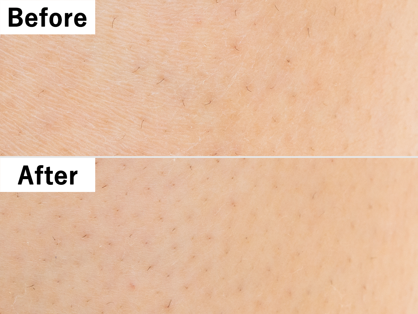 パイナップル豆乳 除毛クリームを全14商品と比較 口コミや評判を実際に使ってレビューしました Mybest