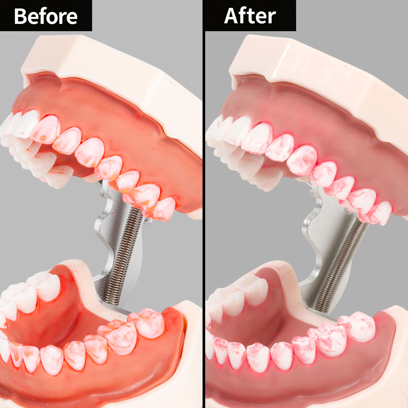 ハブラシ 4
