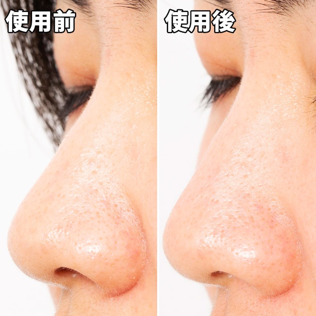 ナリスアップ 毛穴すっきりパックを他商品と比較 口コミや評判を実際に使ってレビューしました Mybest ナリスアップ 毛穴すっきりパックを他商品と比較 口コミや評判を実際に使ってレビューしました Mybest