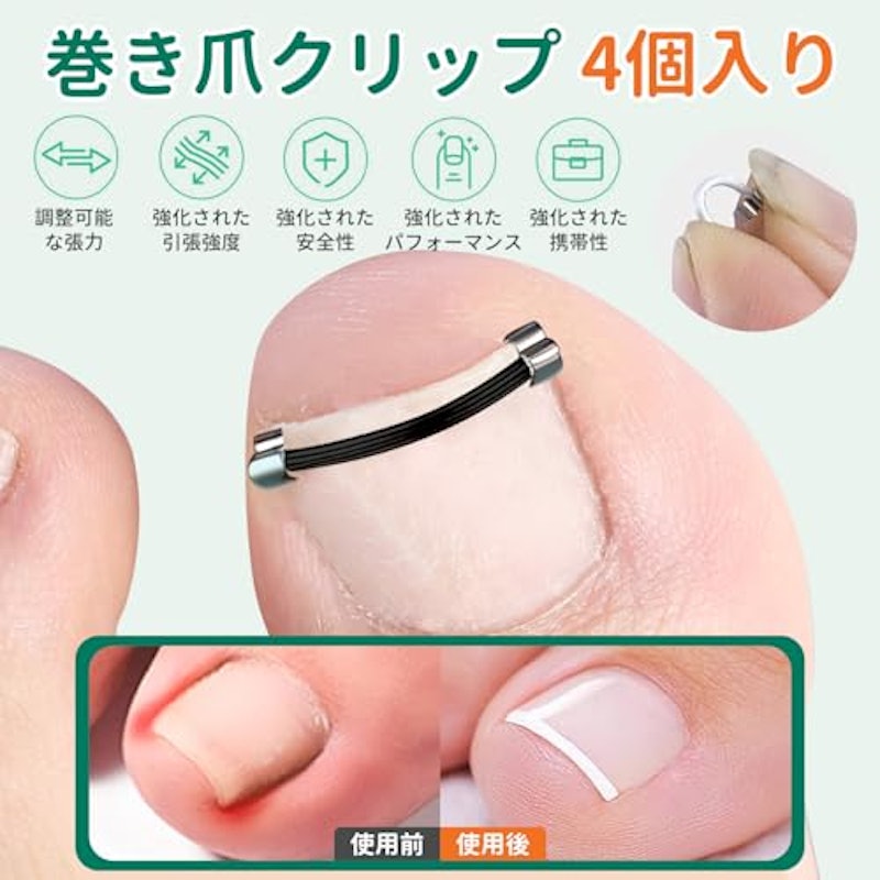巻き爪クリップ 3