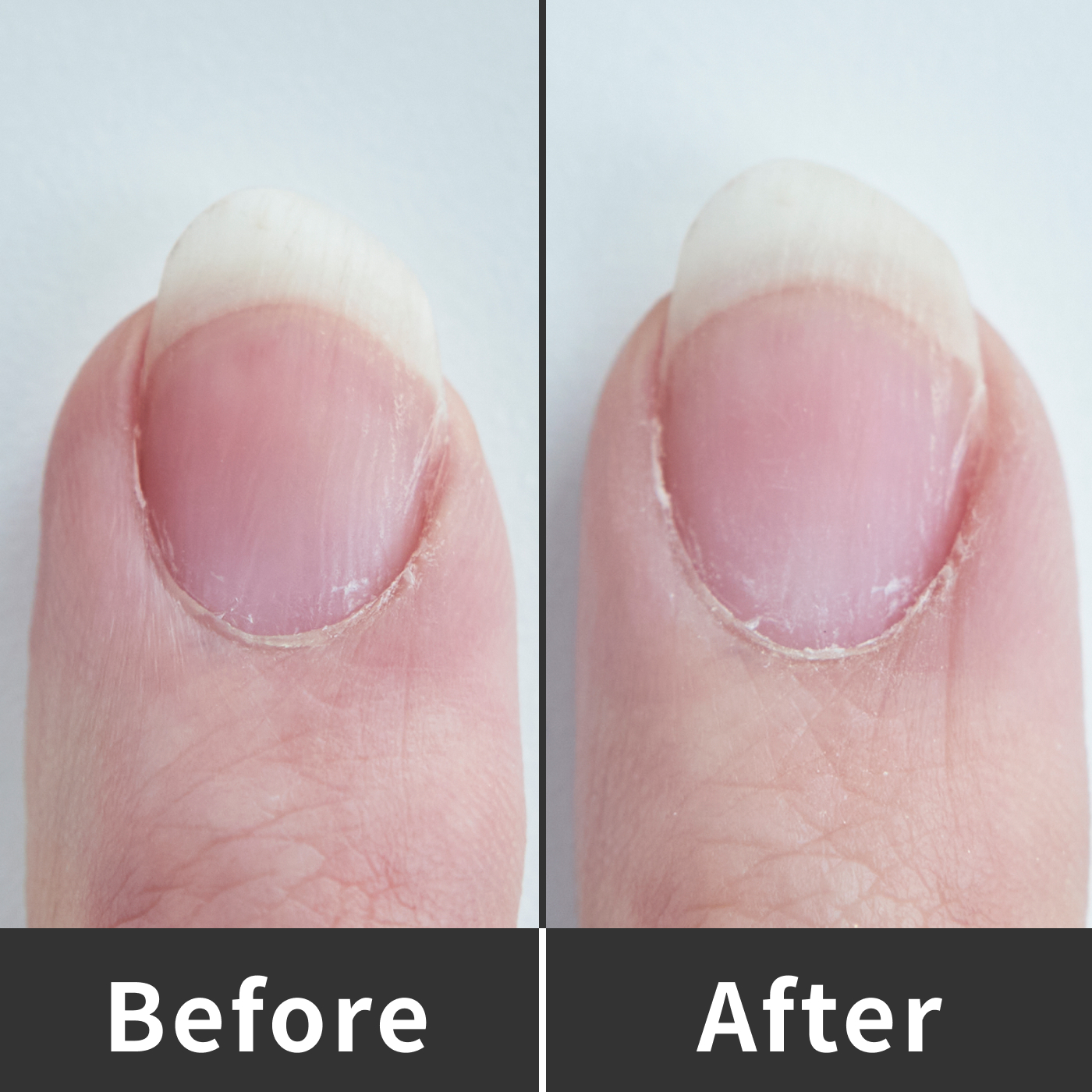 シャンテイ デュカート 爪ミガキセットを全18商品と比較 口コミや評判を実際に使ってレビューしました Mybest