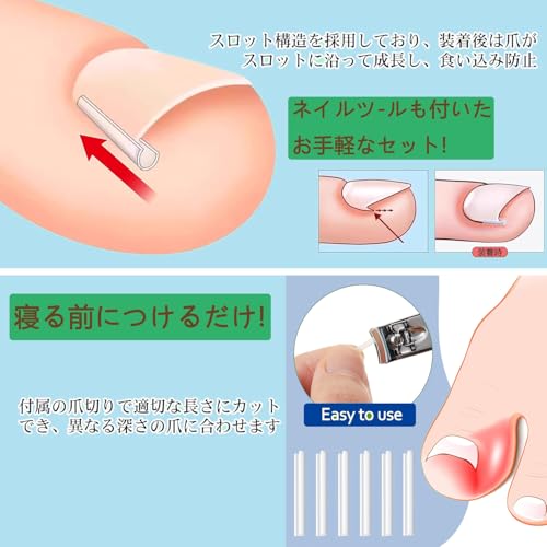 巻き爪クリップ 4