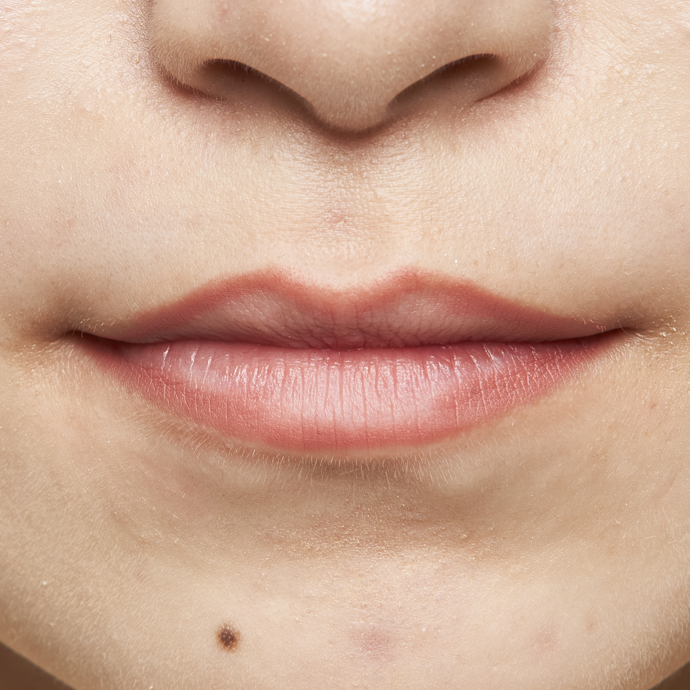 唇 の ふち が かゆい