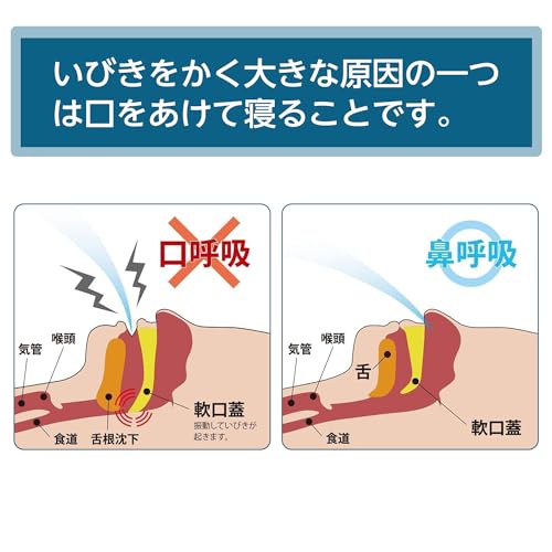 口閉じテープ 3