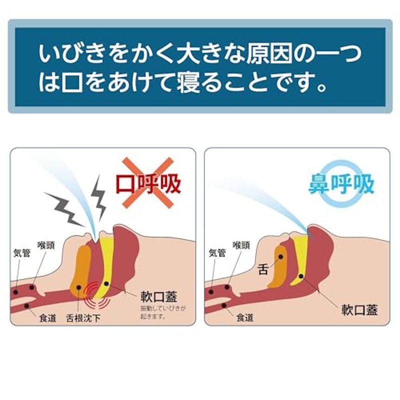 口閉じテープ 3