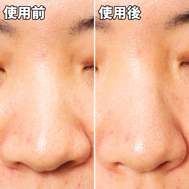 ナリスアップ 毛穴すっきりパックを他商品と比較 口コミや評判を実際に使ってレビューしました Mybest