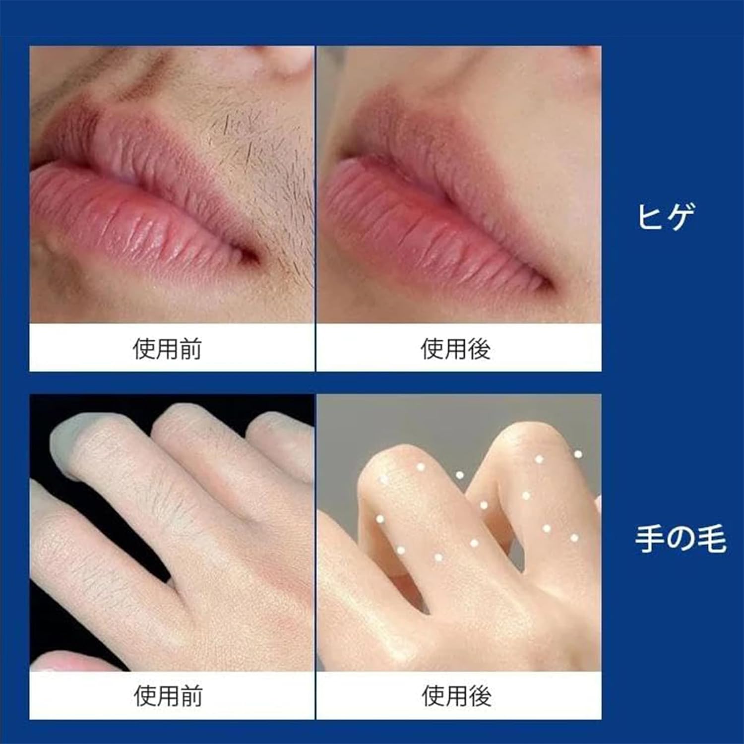 脱毛クリーム 5