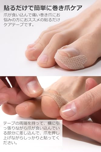 巻き爪テープ 3