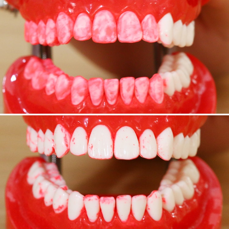 パナソニック 音波振動ハブラシ ドルツ EW-DM62をレビュー！クチコミ