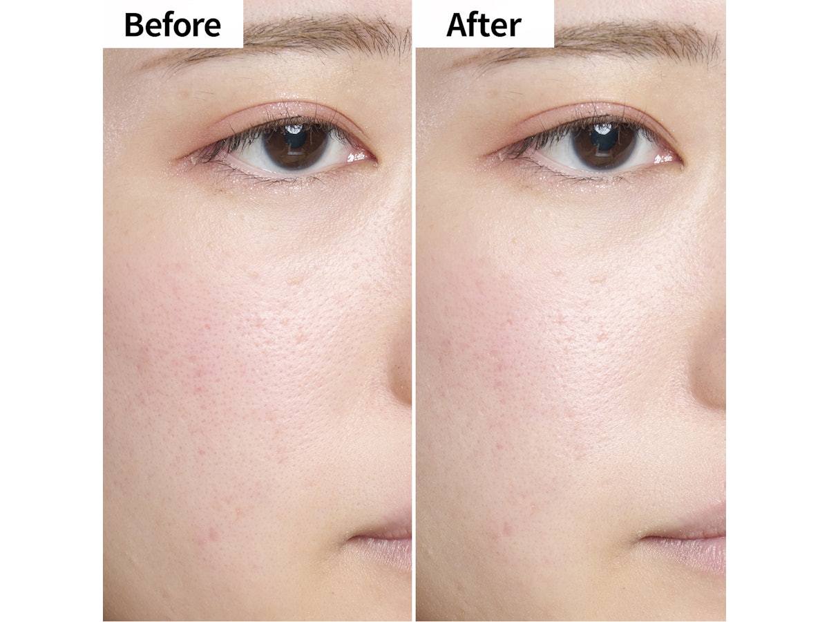 SHISEIDO フューチャーソリューション LX トータル ラディアンス SHISEIDO フューチャーソリューション LX トータル ラディアンス